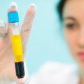 Spekulativer Biotech-Verdoppler? Deutsche Bank rät hier zum Kauf!