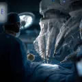 INTUITIVE SURGICAL - Abverkauf nach Zahlen